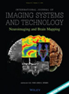 International Journal Of Imaging Systems And Technology期刊