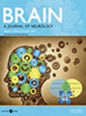 Brain期刊